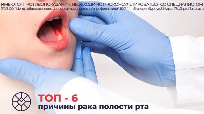 Причины рака полости рта
